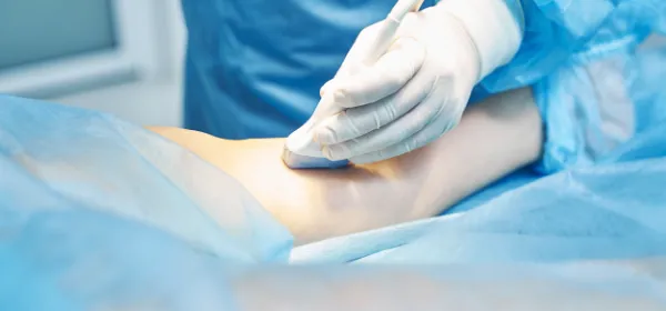 Mikrohullámú műtét